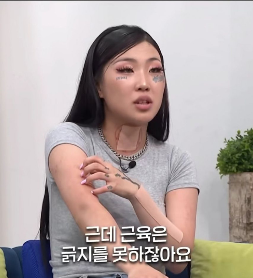 본문 이미지